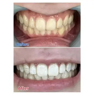 M渋谷店所属・M渋谷 ホワイトニングのエステ・リラクイメージ