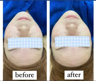 RE:moom リムーム/脱毛エステのエステ・リラクイメージ