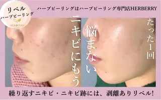 ハーブピーリング専門店HERBERRY難波心斎橋店所属・ハーブピーリング専門 HERBERRY冨永のエステ・リラクイメージ