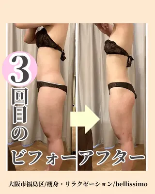 bellissimo 【ベリッシモ】所属・ちひろ　痩身/ハーブ bellissimoのエステ・リラクイメージ