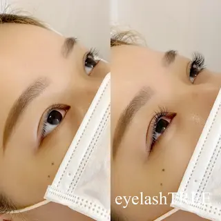 マツエク・マツパ まつげ、毛穴 TREEのエステ・リラクイメージ