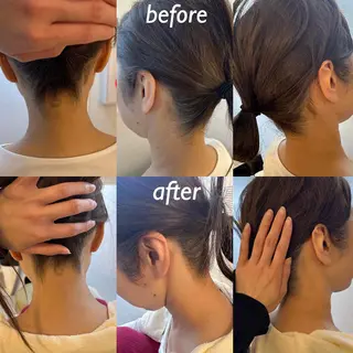 うなじ脱毛/美肌脱毛 LABELのエステ・リラクイメージ