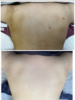 菊池 歩美のマツエク・マツパデザイン