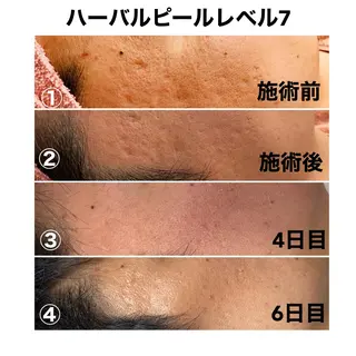 アロマ•ピーリング SalonYokoのその他イメージ