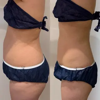 beautysalon RAVIS所属・東大阪/韓国肌管理/ 痩身バスト専門店のエステ・リラクイメージ