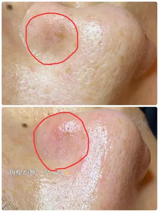 多摩境Beauty Salon  ViVi所属・多摩境ViVi chinamiのエステ・リラクイメージ