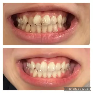 Cerise La La(スリーズララ)所属・まつ毛パーマ×脱毛 スリーズララ🌼のエステ・リラクイメージ