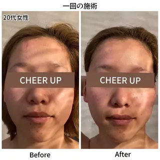 CHEER UPのエステ・リラクイメージ