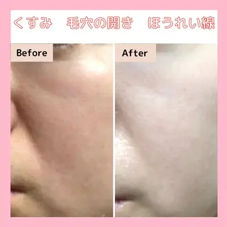 エステサロン　Sブランペタル所属・三沢市エステサロン Sブランペタルのエステ・リラクイメージ