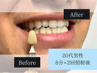 ホワイトニングカフェ原宿店所属・ホワイトニングカフェ 原宿店のエステ・リラクイメージ