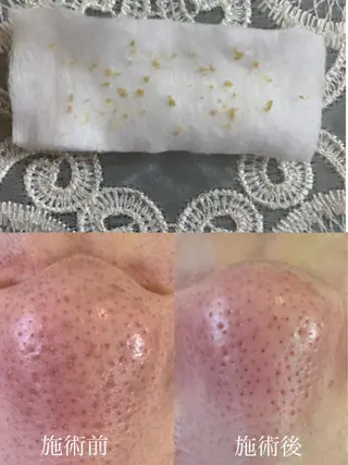 後藤 あきこのマツエク・マツパデザイン