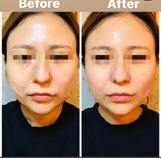 美顔秘密基地新宮所属・美顔秘密基地 新宮のその他イメージ