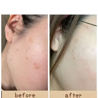 【前橋市】毛穴洗浄× オールハンドリンパのエステ・リラクイメージ