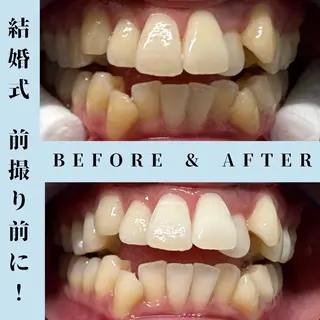 メンズ セルフホワイトニング Dolce水戸店のその他イメージ