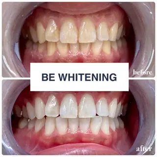 ホワイトニング専門店 ビーホワイト金山のその他イメージ