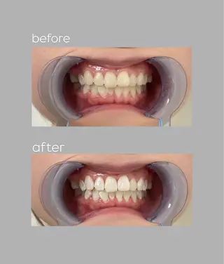 White33所属・aoi 🦷❤︎のその他イメージ