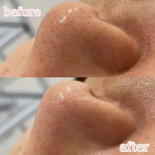 肌管理専門店Whitelabo堺東店所属・おだ あみのエステ・リラクイメージ