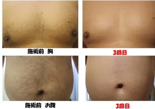 Salon Ree Belle(サロン リベル)所属・サロン リベル YUKAのエステ・リラクイメージ