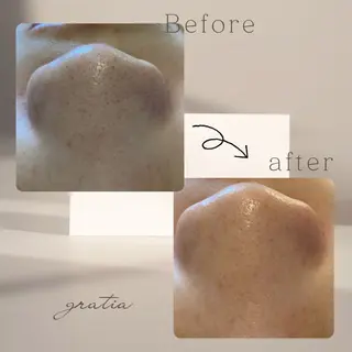 美肌脱毛と癒しのﾌﾟﾗｲﾍﾞｰﾄｻﾛﾝ。gratia~ｸﾞﾚｲﾃｨｱ~所属・gratia ~ｸﾞﾚｲﾃｨｱ~のエステ・リラクイメージ