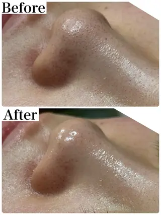 脱毛&フェイシャル 専門店muro.のエステ・リラクイメージ