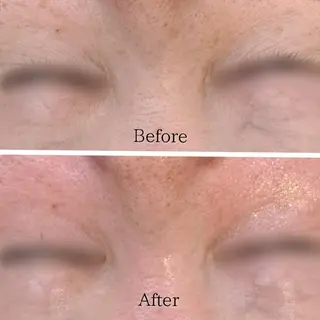 Hisui 種村のエステ・リラクイメージ