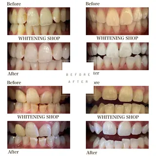 ホワイトニングショップ伊丹店所属・ホワイトニング ショップ伊丹店のその他イメージ