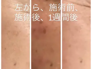 サロンマミ MAMIのエステ・リラクイメージ