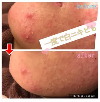 セミロング カラー パーマ ヘアアレンジ メンズ キッズ ネイル マツエク・マツパ 四つ星サロン🎖 腸＆ニキビケアに特化のエステ・リラクイメージ