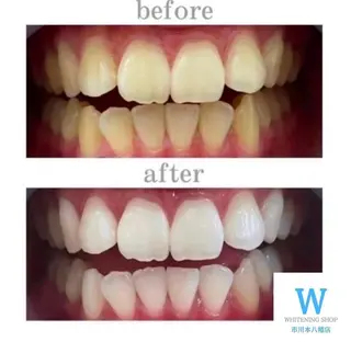 ホワイトニング ショップ本八幡店のエステ・リラクイメージ