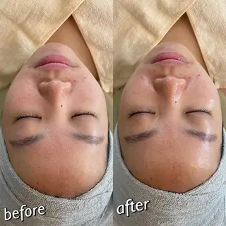 うなじ脱毛/美肌脱毛 LABELのエステ・リラクイメージ