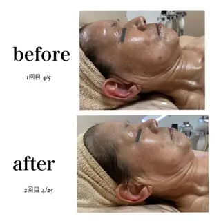 stella所属・stella都度払い 痩身小顔まつげパーマのマツエク・マツパデザイン