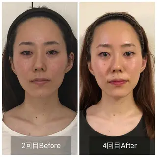 🌈Gemini 新大阪🌈の眉毛・アイブロウイメージ