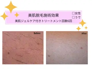 VIKI BEAUTY  クレイハーブピーリング・美肌脱毛専門店所属・VIKI BEAUTYのエステ・リラクイメージ
