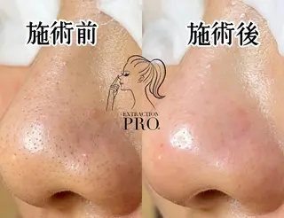 Lipula リプラ所属・毛穴ツヤ肌専門    Lipulaのエステ・リラクイメージ