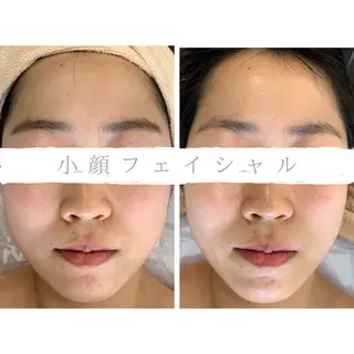 小顔&デコルテ Spa　“koti”のエステ・リラクイメージ