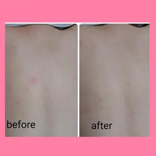 肌ケア＆毛穴洗浄 Cheriのエステ・リラクイメージ