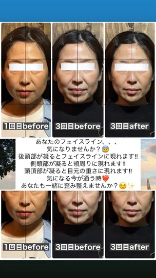 💎後悔させない小顔 矯正💎イトヤマ🌱のエステ・リラクイメージ