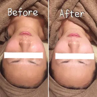 ビューティーサロン　サランブル所属・肌質改善エステサロン サランブルのエステ・リラクイメージ