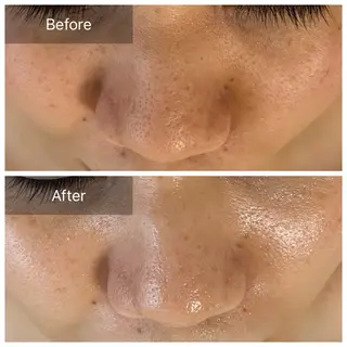 毛穴が見えなくなるサロン  Horo所属・岡 えり子のエステ・リラクイメージ