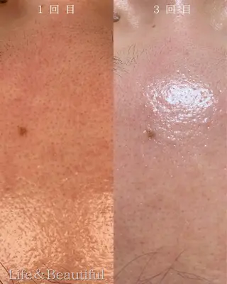 Life＆ Beautifulのエステ・リラクイメージ