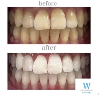 ホワイトニング ショップ本八幡店のエステ・リラクイメージ