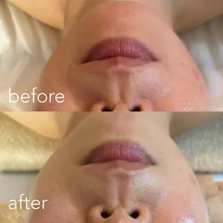 エステティックサロン Liente(リアンテ)所属・Hashimoto .のエステ・リラクイメージ