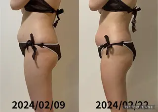 private salonBiBowのエステ・リラクイメージ