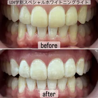 whitening salon yatto.所属・ホワイトニングサロン yatto.のその他イメージ
