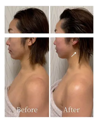 Lani Moon所属・⟡ 京都 小顔  ⊹ Lani Moonのエステ・リラクイメージ