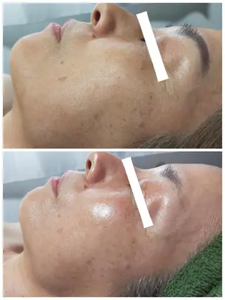 山田 愛のネイルデザイン