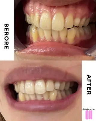 セルフホワイトニングサロン  エクシアホワイト 王寺店所属・エクシア王寺 NISHIKAWAのその他イメージ