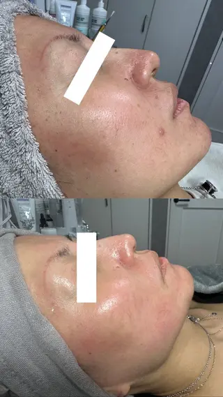 マツエク・マツパ SAYAKA 🫧のマツエク・マツパデザイン