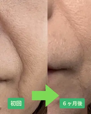 河輪 鍼灸接骨院のエステ・リラクイメージ