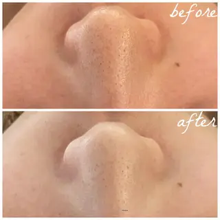 メンズ メナード岐阜市茜部 杉浦のエステ・リラクイメージ